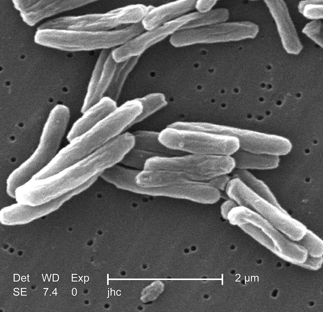 Grayscale electron micrograph showing rod-shaped tuberculosis bacteria.
