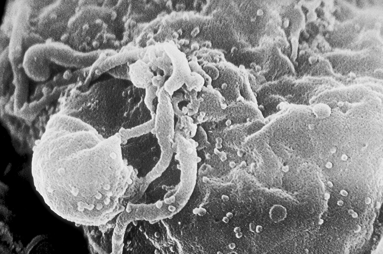Grayscale electron micrograph showing HIV-1 virions as small round bumps budding from a cultured lymphocyte.