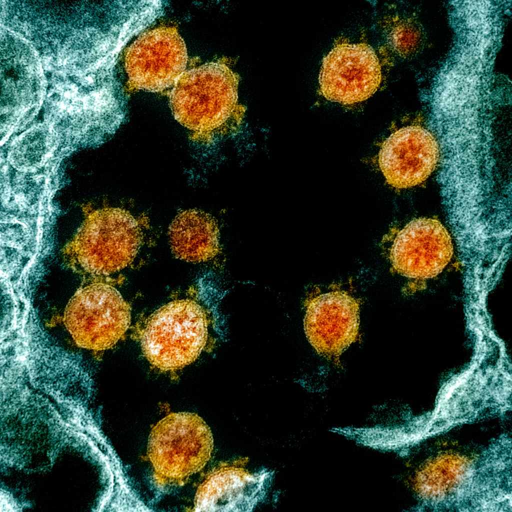 File: orange SARS-CoV-2 particles in an electron micrograph.