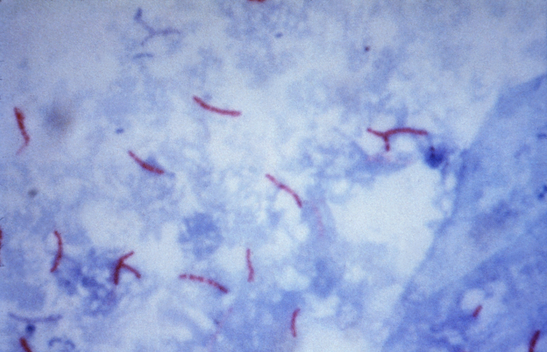 Red rod-shaped bacteria against a blue stained microscopic background.